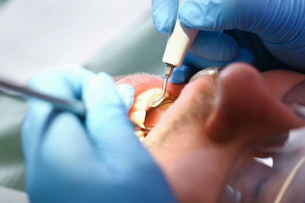 Best Emergency Dental Care for Broken or Chipped Teeth in Triana, AL