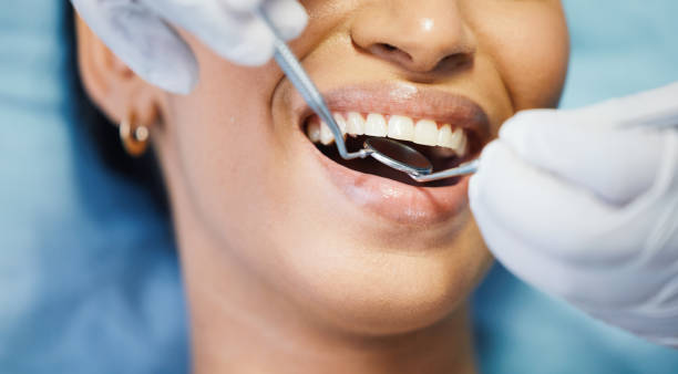 Best Emergency Tooth Extraction in Triana, AL
